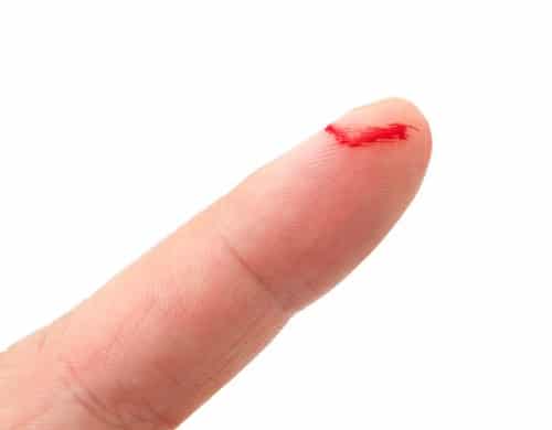 stop how finger bleeding Bet We Health Ginger Know of Didnât Unique 10 You Benefits