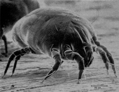 Kill mites - 51 Extraordinary Everyday Uses for Hydrogen Peroxide